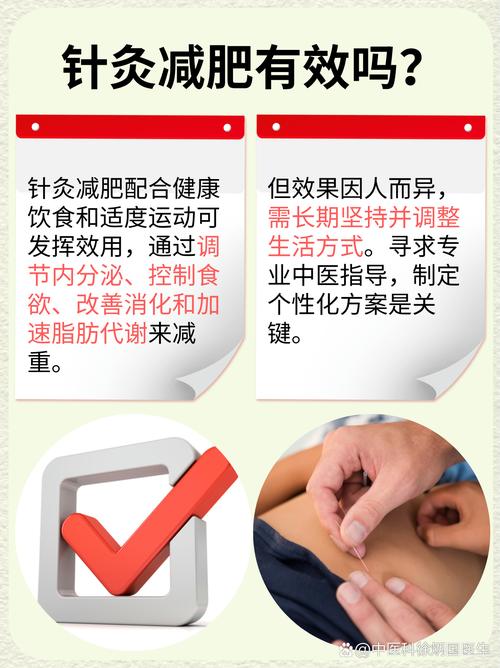 针灸什么位置可以减肥