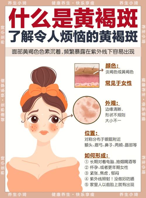 为什么脸上长黄褐斑