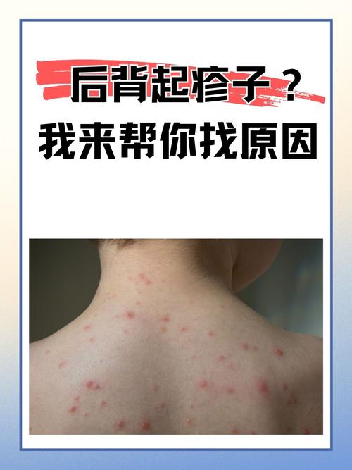 后背起疙瘩是什么原因