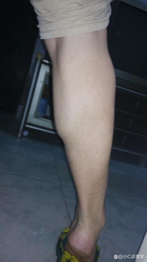 为什么跑步腿会变粗