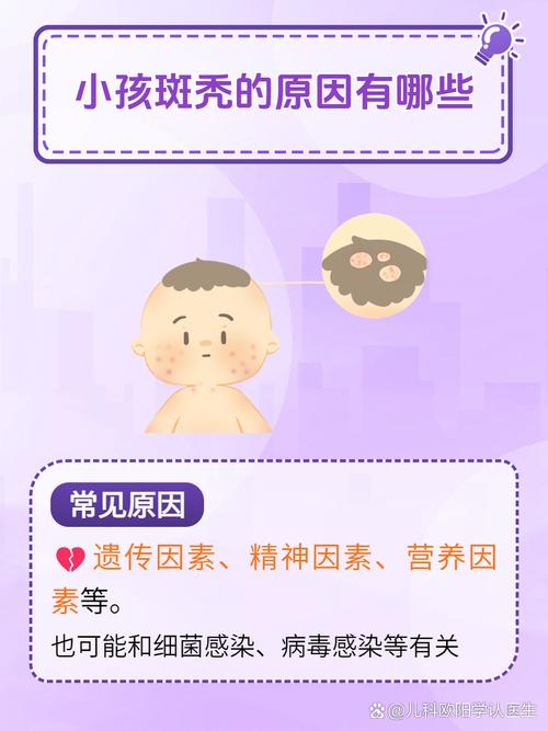 小孩斑秃是什么原因