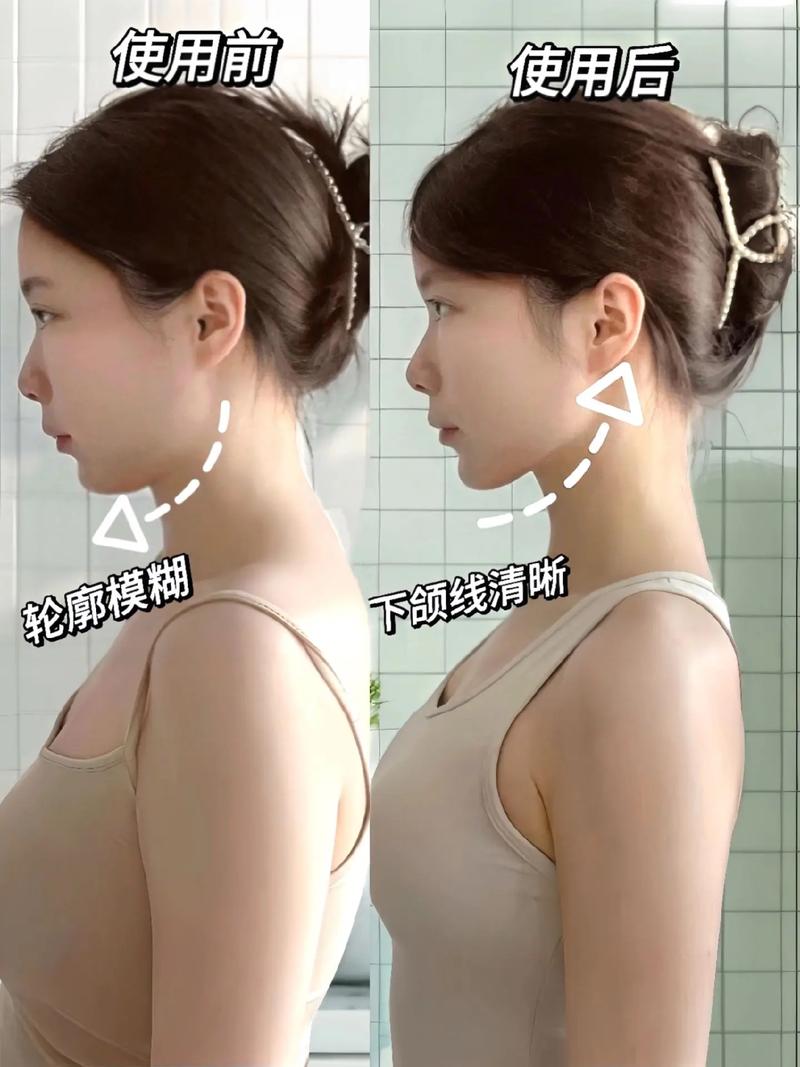 咬肌大是什么脸型