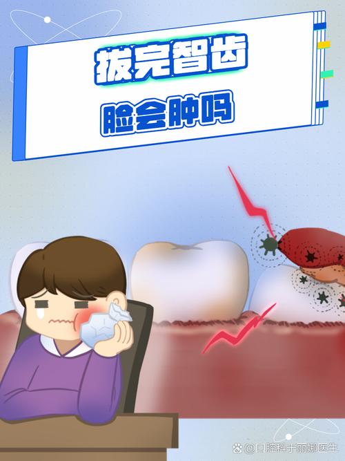 拔牙为什么会脸肿