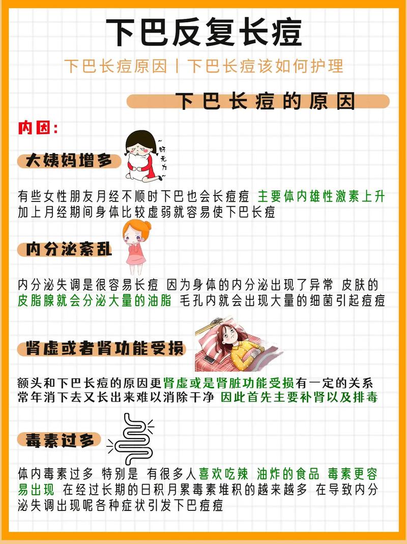 为什么下巴会长粉刺