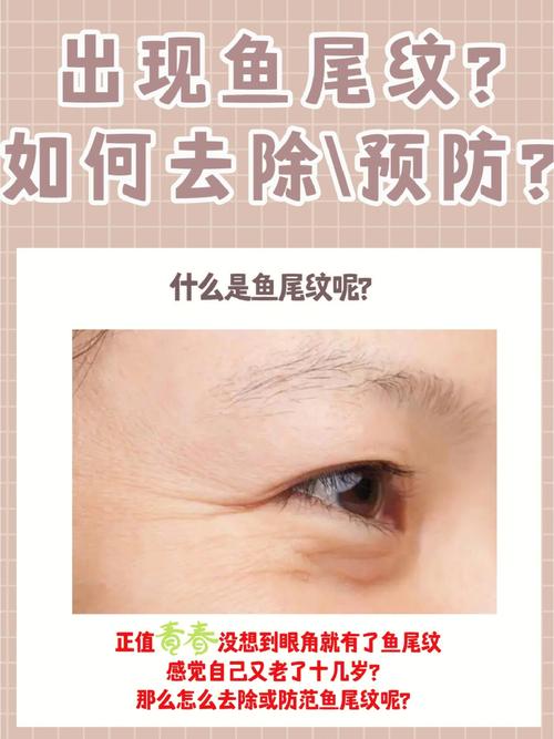 鱼尾纹代表什么