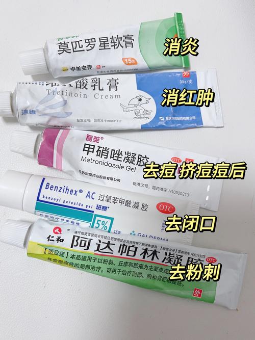 什么去痤疮好