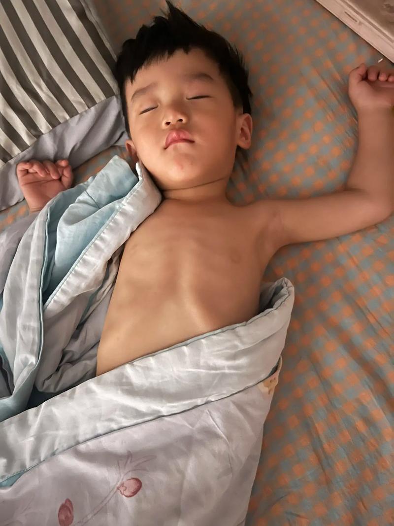 什么是鸡胸病