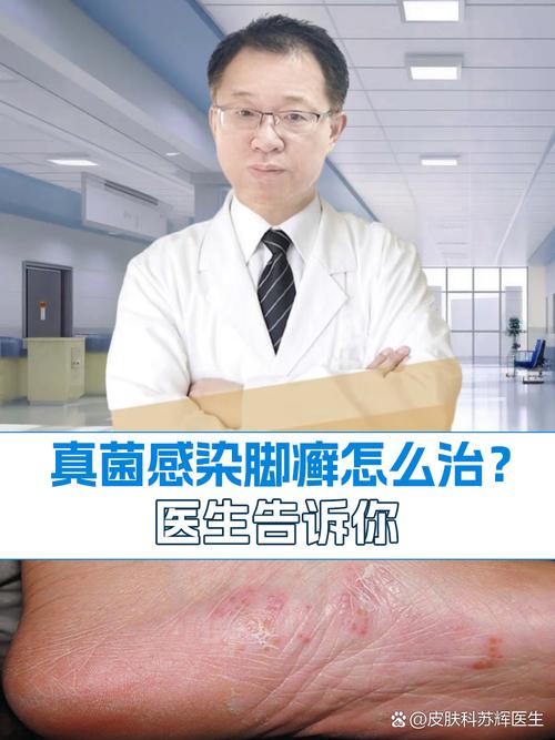 脚癣看什么科