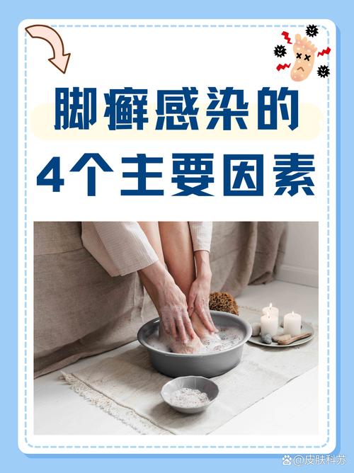 脚癣看什么科