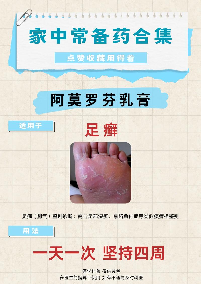 脚癣看什么科