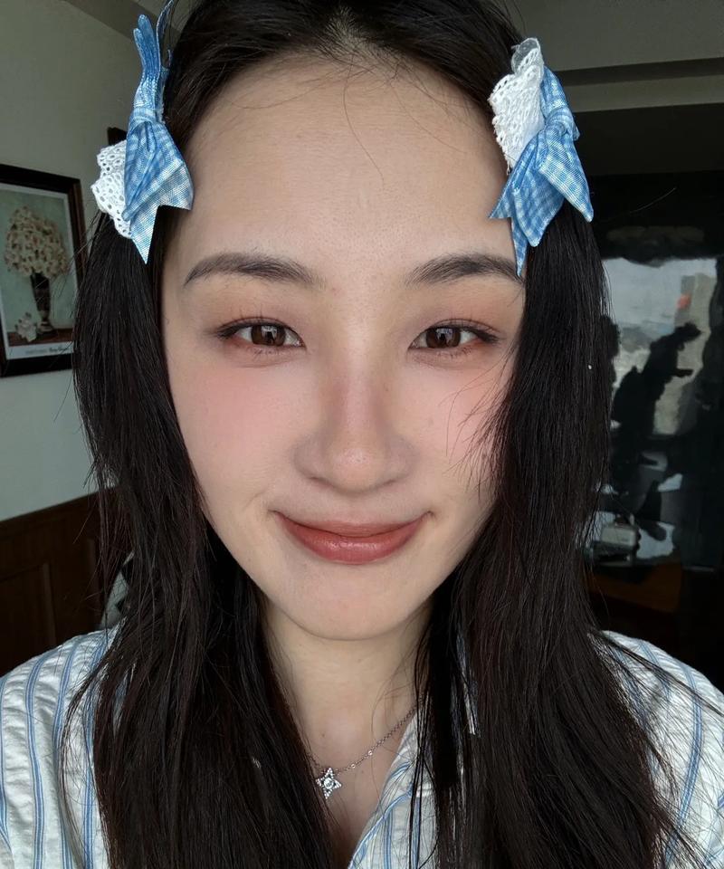 什么大脑门