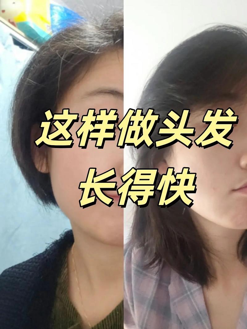 为什么头发长得很快