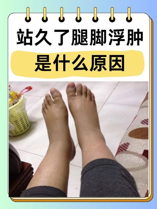 脚部浮肿是什么原因