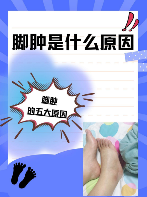 脚部浮肿是什么原因