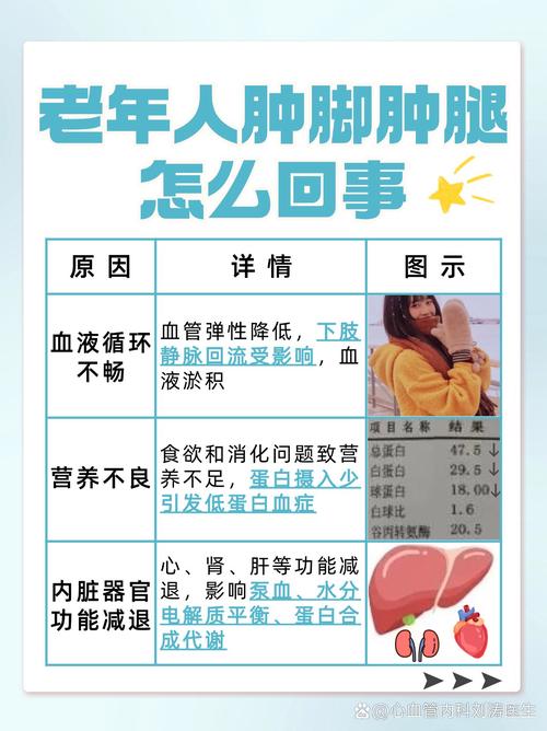 脚部浮肿是什么原因