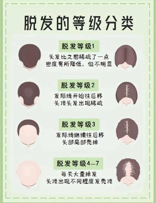 容易掉发是什么原因