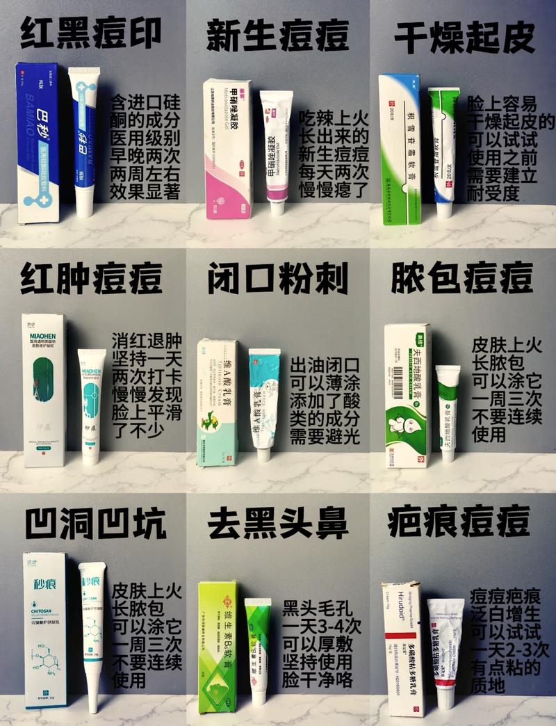 有什么祛痘印的药膏