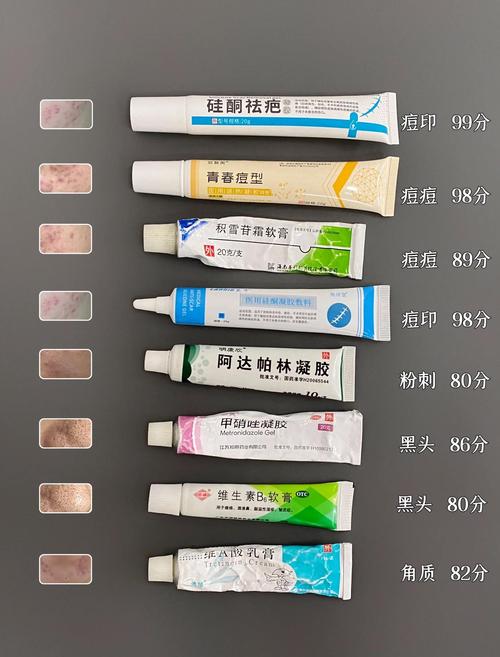 有什么祛痘印的药膏