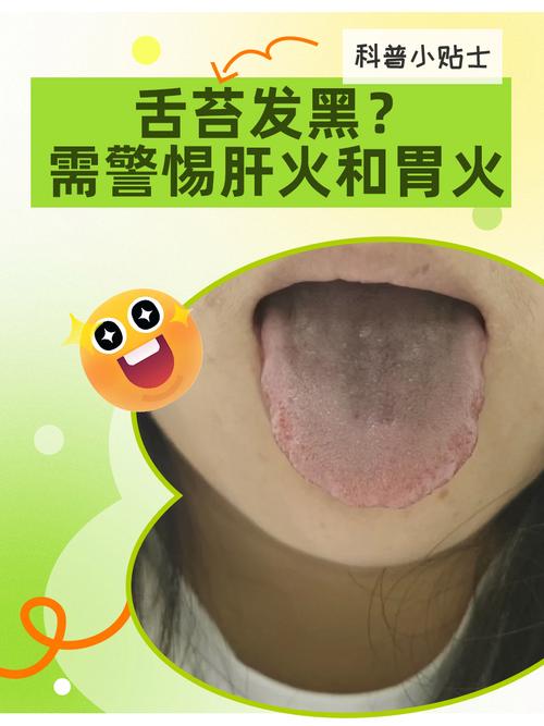 舌苔变黑是什么原因