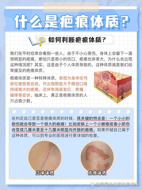 为什么有疤不能当兵