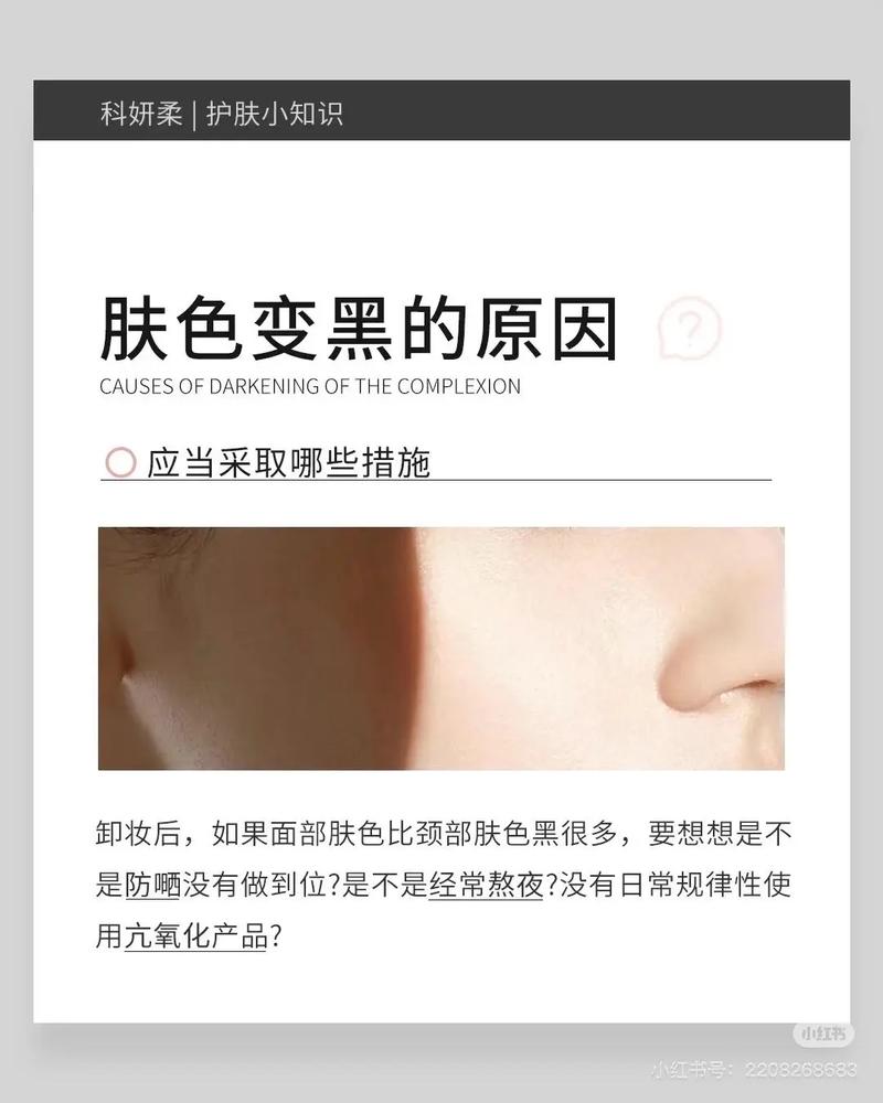 面色发黑是什么原因