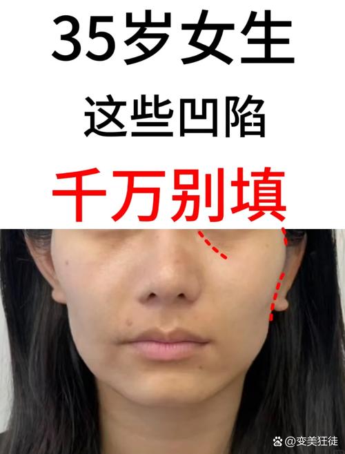 为什么脸部会凹陷