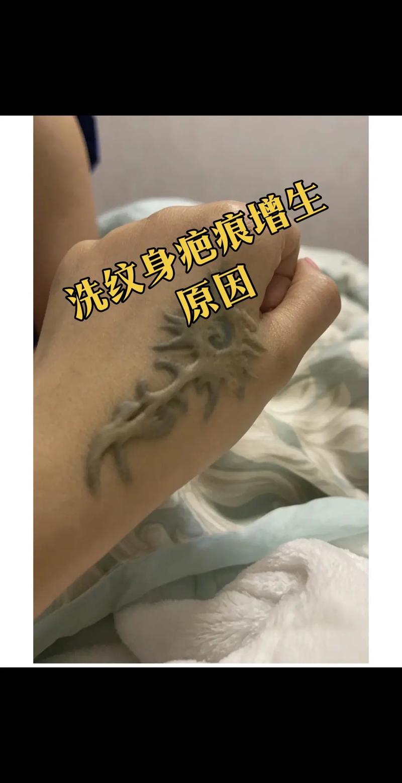 纹身增生什么意思