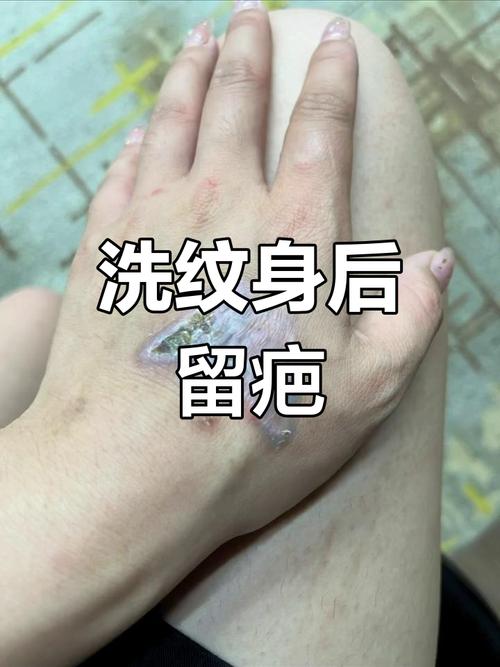 纹身增生什么意思