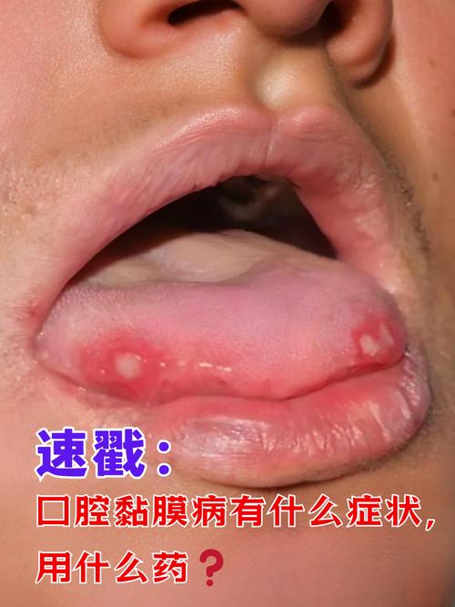 口腔外科看什么病