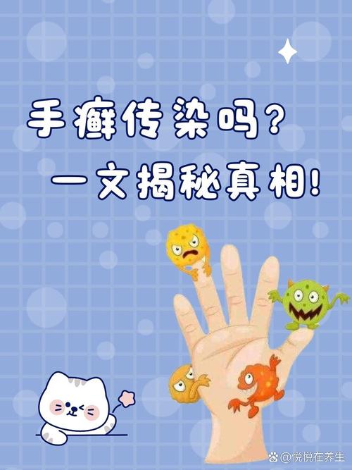 为什么会得手癣
