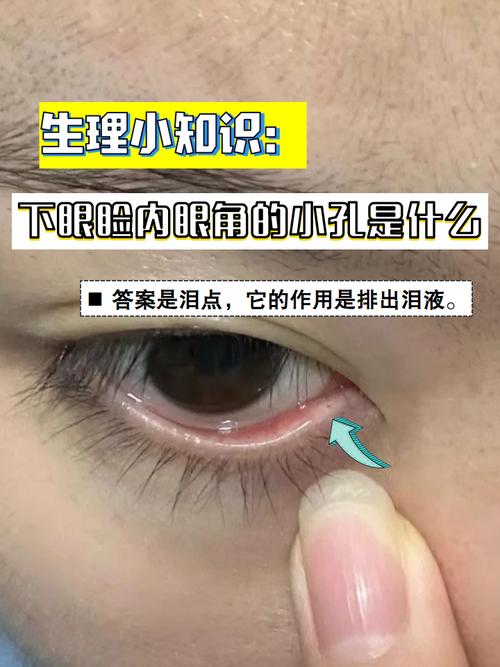 什么是内眦