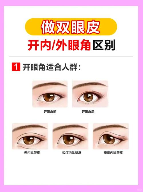 什么是内眦