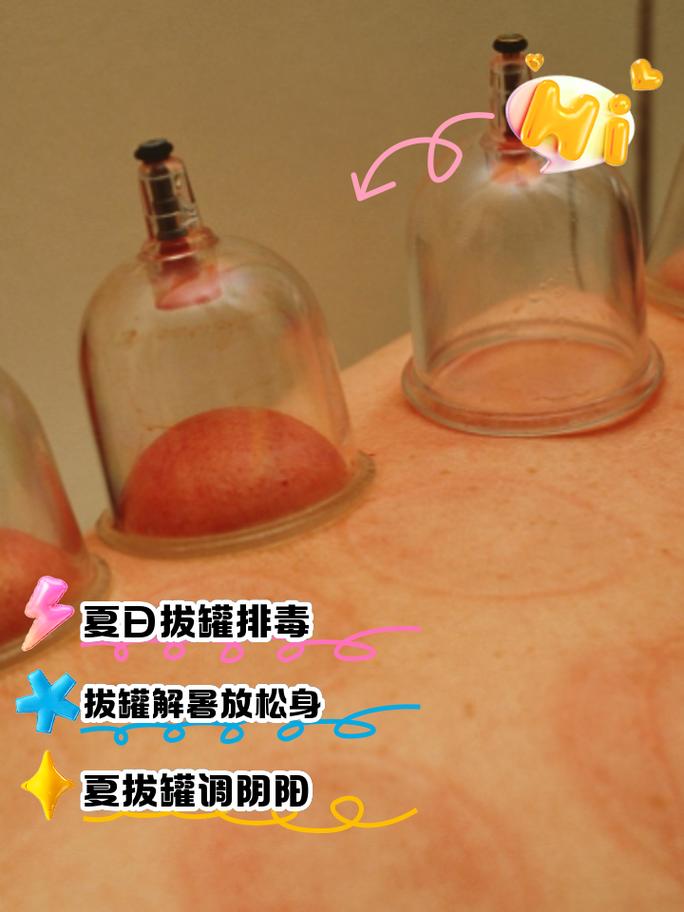 减肥拔罐的危害是什么
