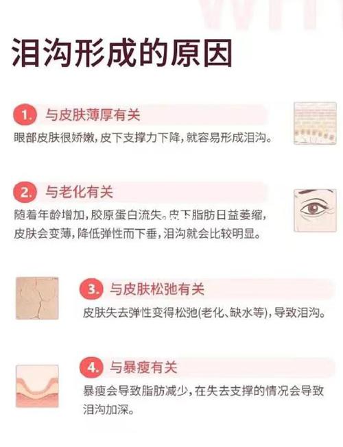 为什么泪沟