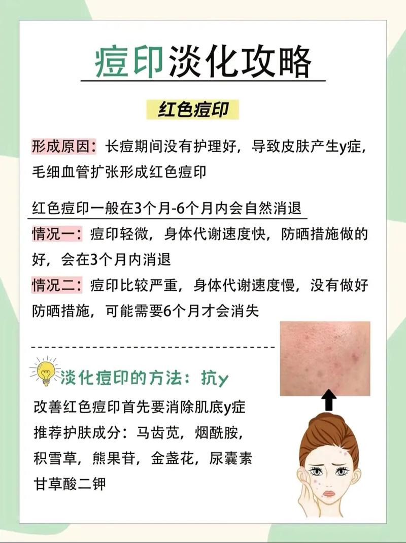 什么去除痘印