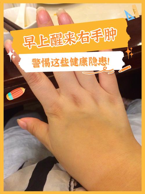 一只手肿是什么原因