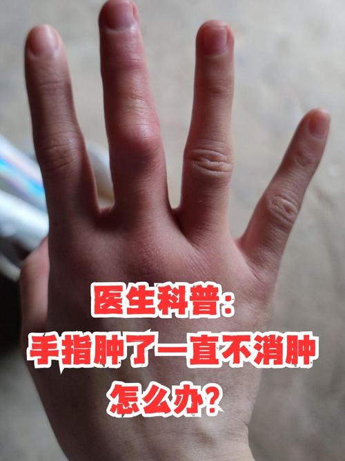 一只手肿是什么原因