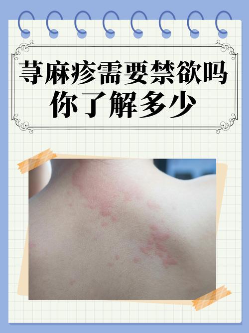什么病会引起荨麻疹