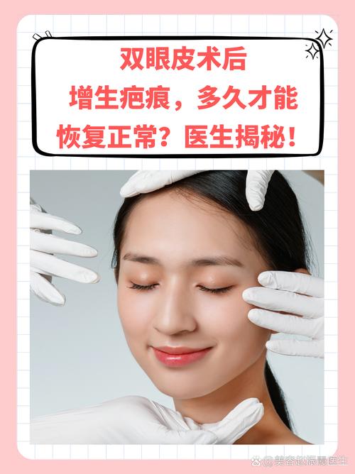双眼皮为什么会消失