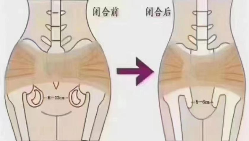 屁股变大是什么原因