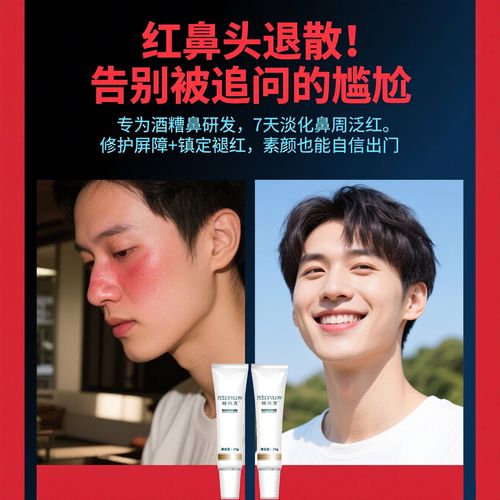 鼻子长痘用什么药膏