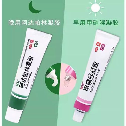 鼻子长痘用什么药膏