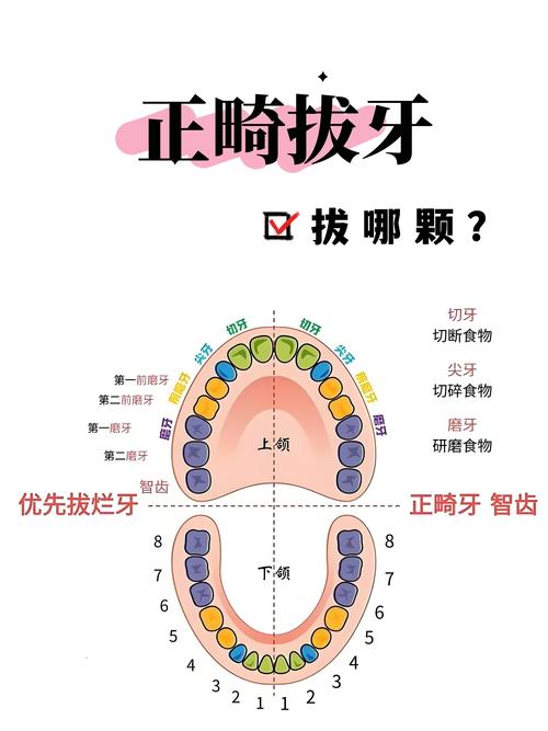 为什么矫正牙齿要拔牙
