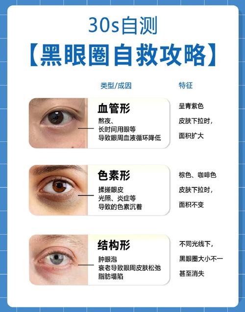 什么是熊猫眼