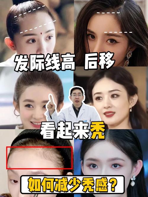 发际线高说明什么