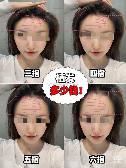 发际线高说明什么