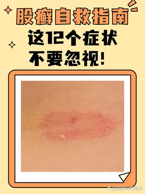 股藓挂什么科