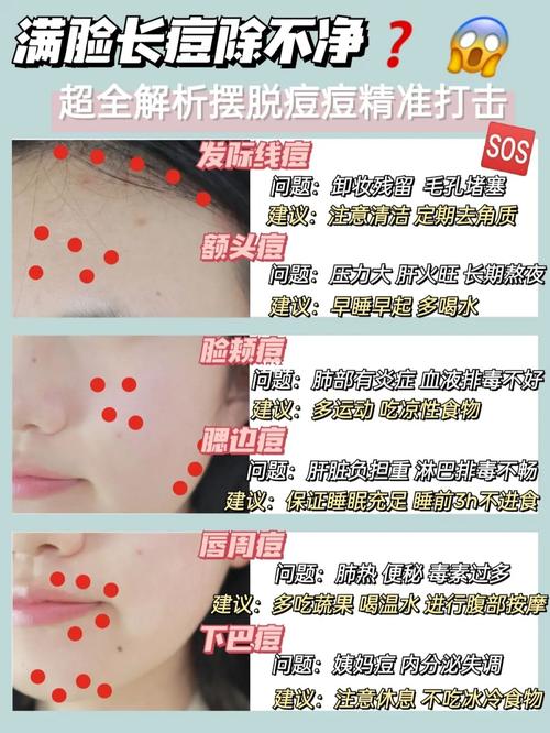 痘痘闭口什么意思