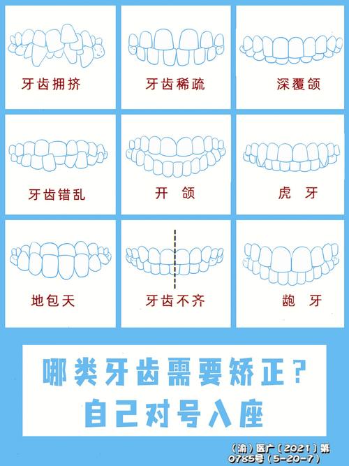 牙齿矫正什么价格