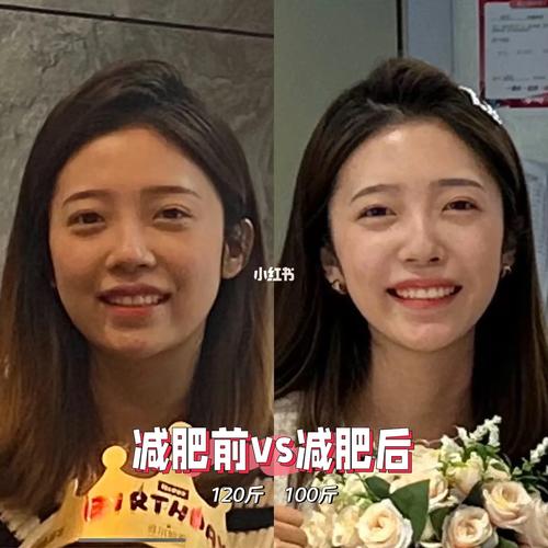 减肥为什么脸不瘦 身体瘦了